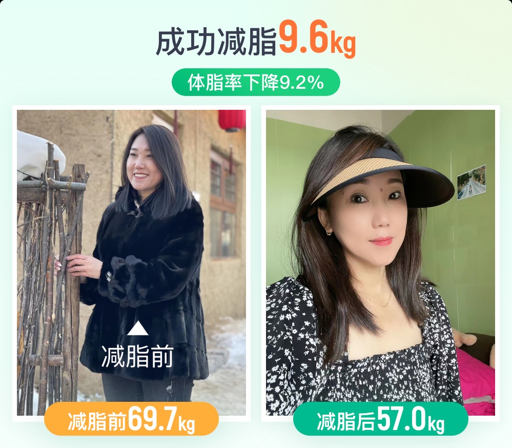 荨麻疹患者，长期激素摄入还能成功减脂吗？