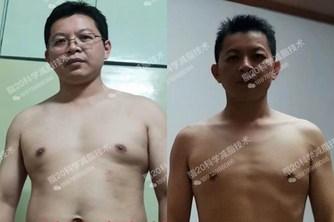 憨憨的牙医生瘦身成功变帅了！
