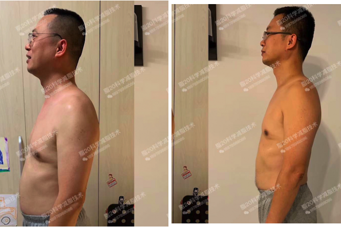 小基数减脂，专攻大肚腩