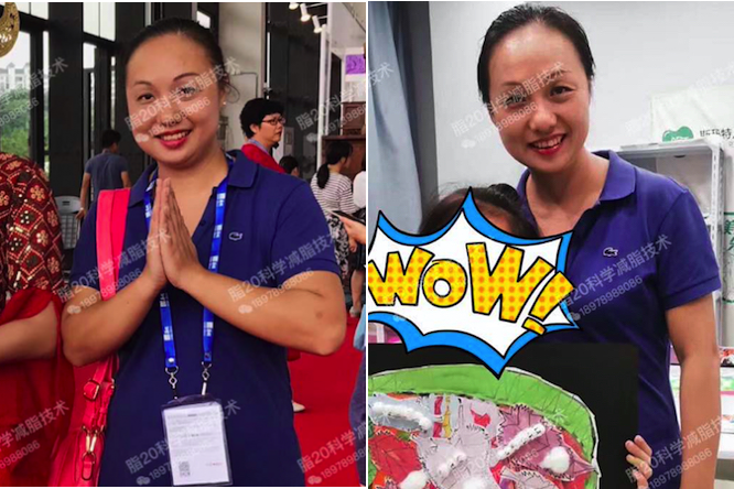 瘦吧新一代科学减脂是我的减肥终点站