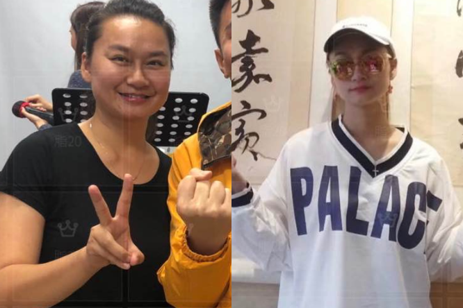 曾经的运动员疏于身材的管理胖成大妈，经过科学减脂秒变少女