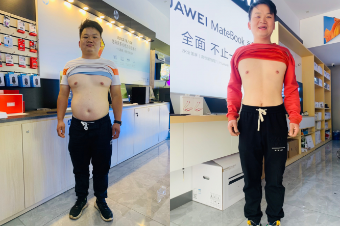 因肥胖出现头昏,威胁到健康而减肥